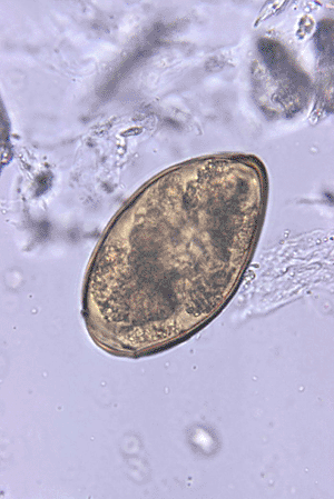 Image: Paragonimus westermani egg (Photo courtesy of Dr. Mae Melvin/Centers for Disease Control and Prevention - CDC). Image: Paragonimus westermani egg (Photo courtesy of Dr. Mae Melvin/Centers for Disease Control and Prevention - CDC).